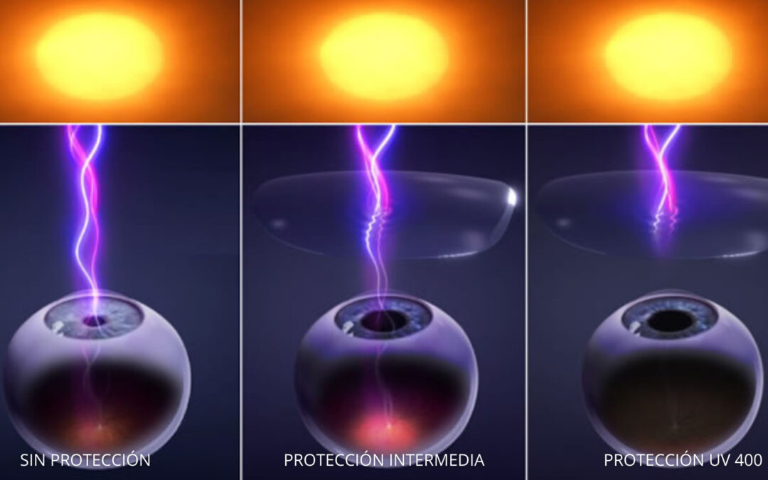 GAFAS DE SOL UV400: TODO LO QUE DEBES SABER